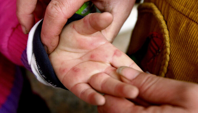 ما هو فيروس أنفلونزا الطماطم وأعراضه وطرق علاجه؟